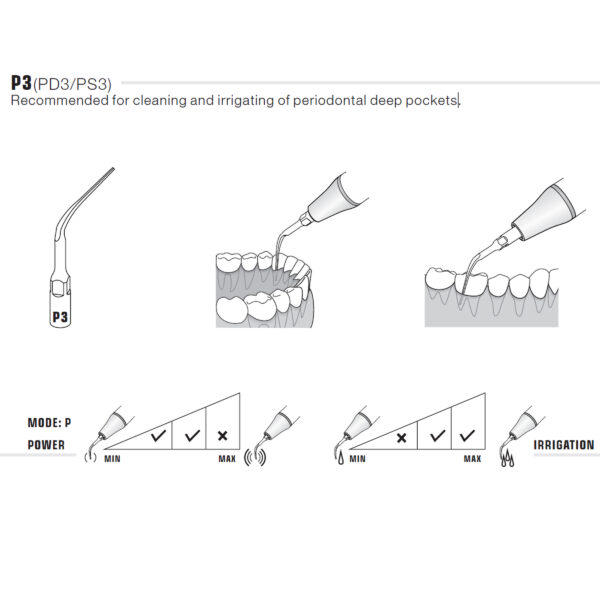 P3 PD3 PS3 Woodpecker DTE Ultrasonic ScalingTip F2 Medical Supplies