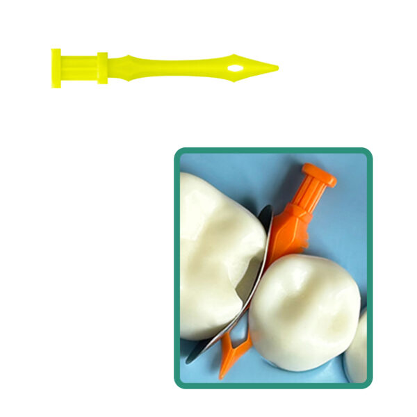 F2M334 Diamond Wedges 40 Pcs Yellow Extra Small .03