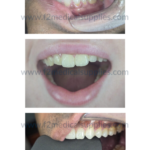 F2M460 Dental Handheld Photography Light Dental Lamp .03 F2 Medical Supplies