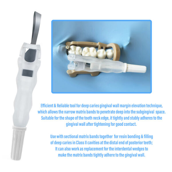 F2M288F Retianer Matrix for Margin Elevation Technique