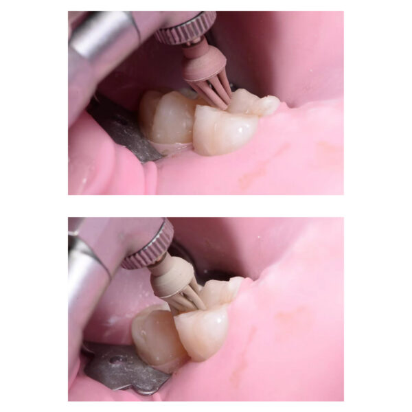 F2M340 F2M341 Occlusal Polishing Burs Medium Fine